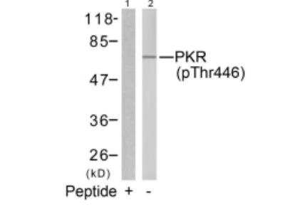 Western Blot: PKR [p Thr446] Antibody [NB100-82156]